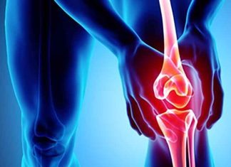 Knee osteoarthritis