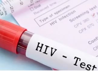 HIV-test