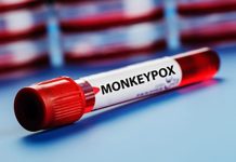 Monkeypox