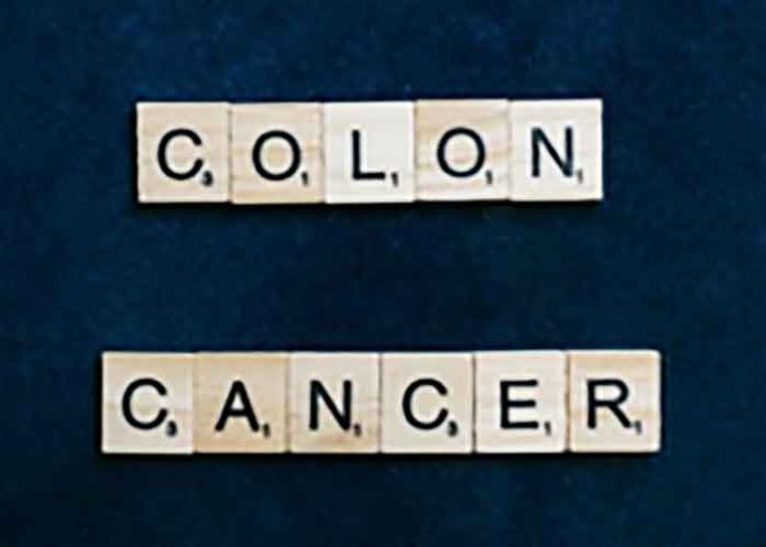 Colon Cancer