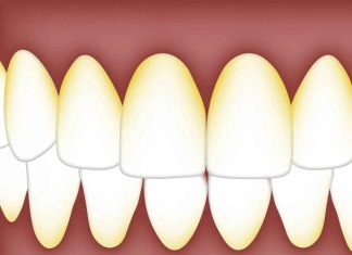 mouth-oral-bacterial