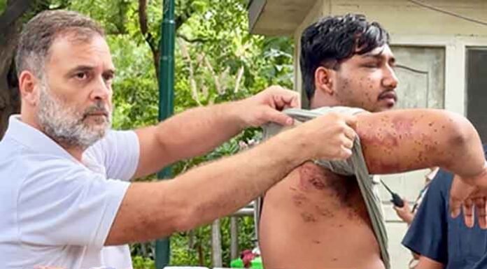 Rahul Gandhi accuses Centre of denying pellet use during CJP protest, demands action Rahul Gandhi of denying pellet use during CJP protest