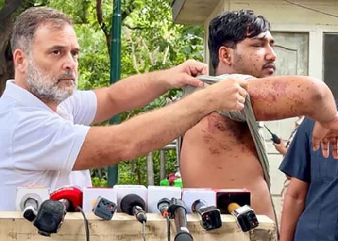 Rahul Gandhi of denying pellet use during CJP protest